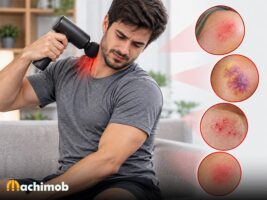 آیا ماساژور برقی ضرر دارد؟ بررسی عوارض و موارد منع مصرف